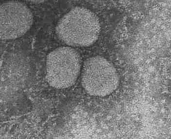 A picture of the Novel Coronavirus, taken by the Department of Microbiology in Hong Kong.